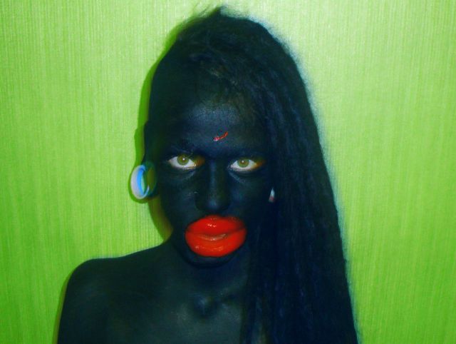 New Photos of the Girl with the World’s Largest Lips