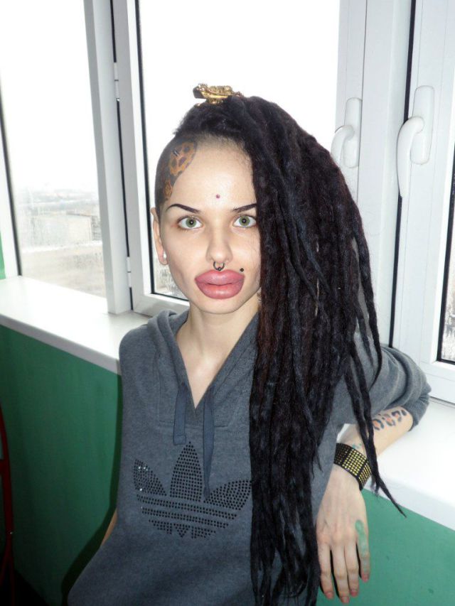 New Photos of the Girl with the World’s Largest Lips