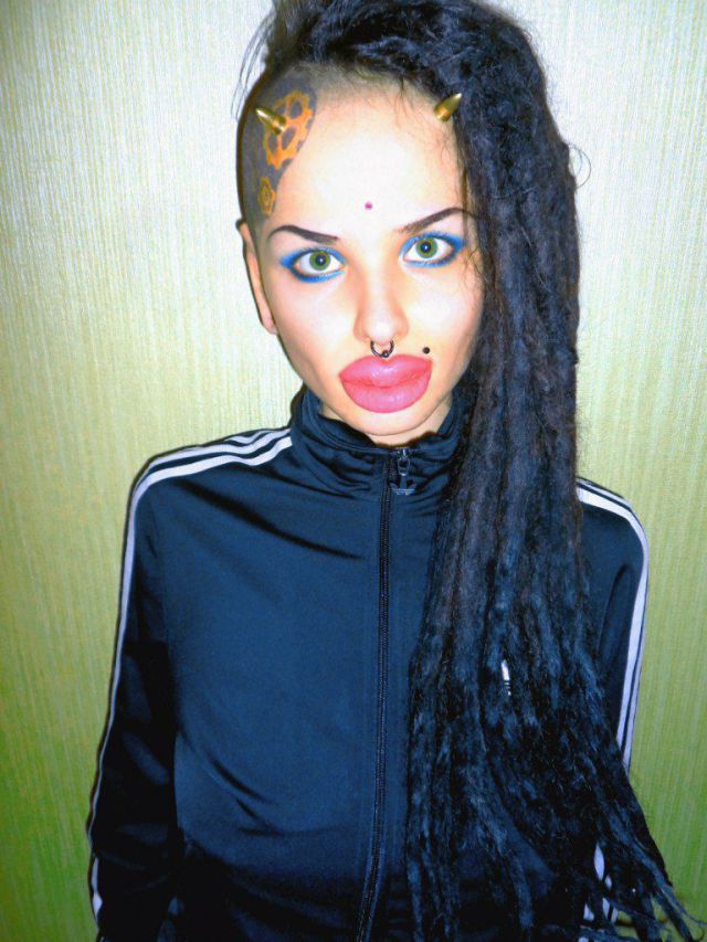 New Photos of the Girl with the World’s Largest Lips