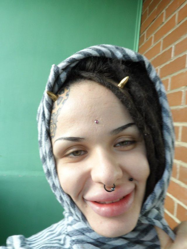 New Photos of the Girl with the World’s Largest Lips