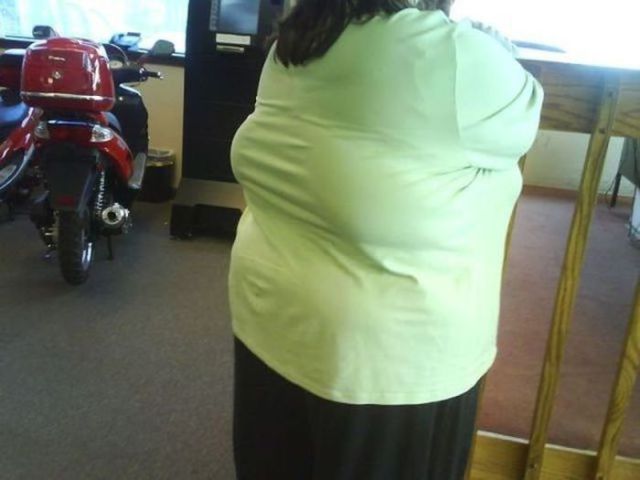 These Fast Food Victims Are a Scary Sight