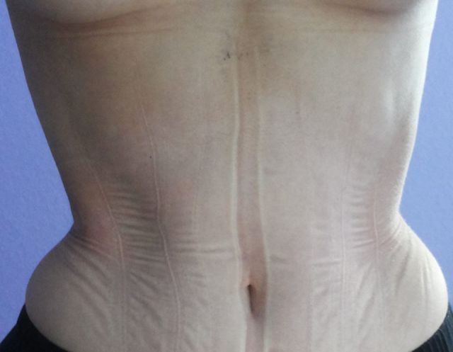 The Woman Who Is “Waisting Away” for Beauty