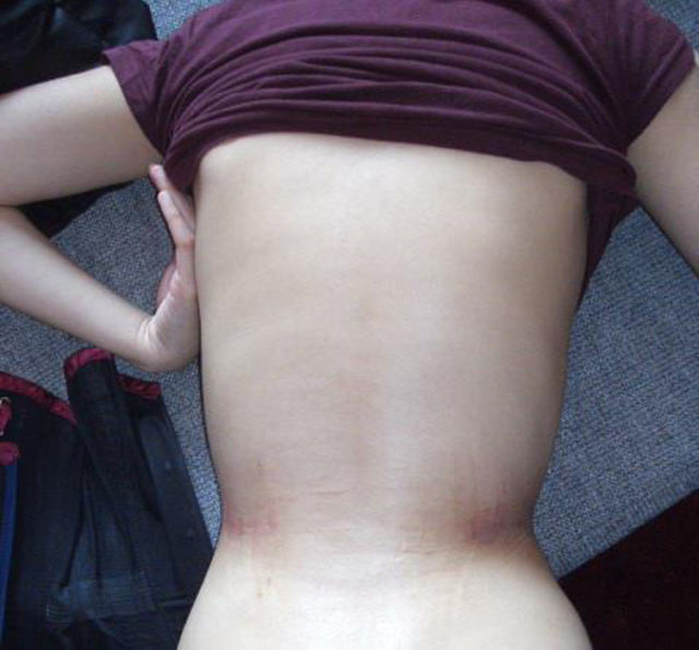 The Woman Who Is “Waisting Away” for Beauty