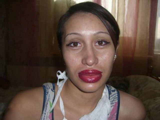 The Crazy Things Girls Do for "Beauty"