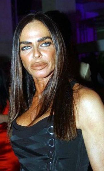 The Crazy Things Girls Do for "Beauty"