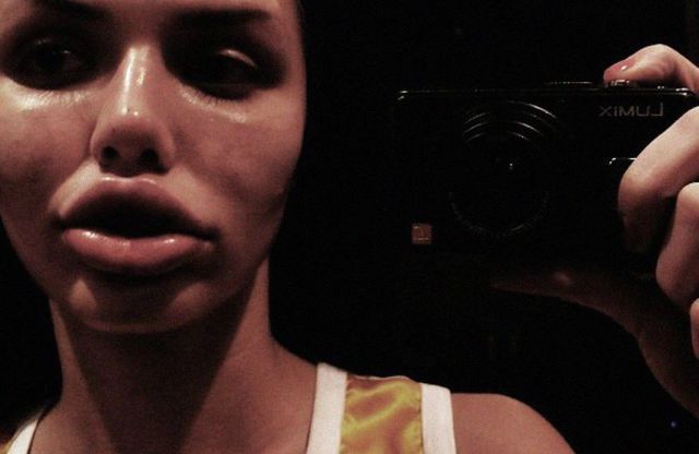 The Crazy Things Girls Do for "Beauty"