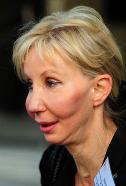 The Crazy Things Girls Do for "Beauty"