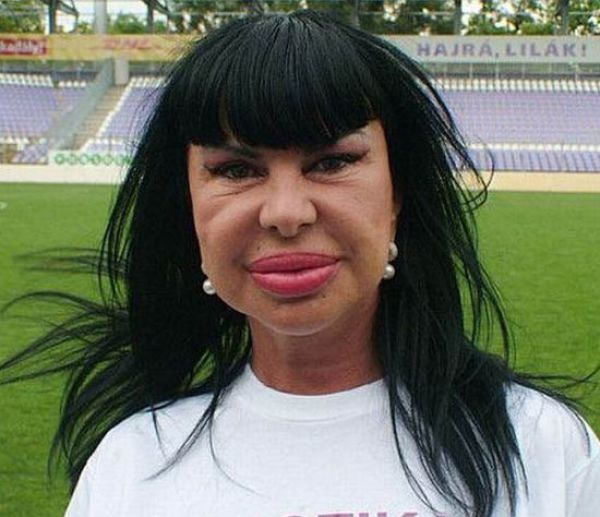 The Crazy Things Girls Do for "Beauty"