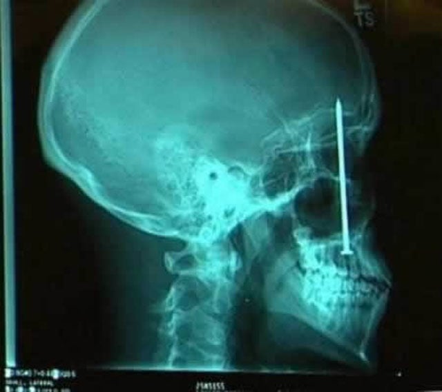 Real X-Rays That Will Shock and Astound You
