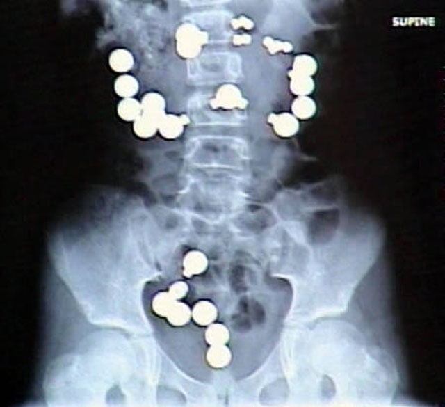 Real X-Rays That Will Shock and Astound You