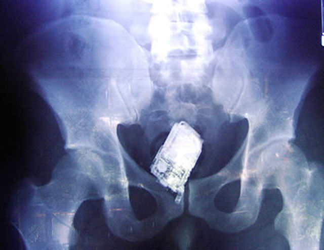 Real X-Rays That Will Shock and Astound You