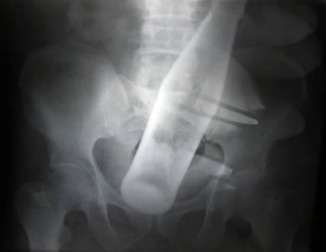 Real X-Rays That Will Shock and Astound You