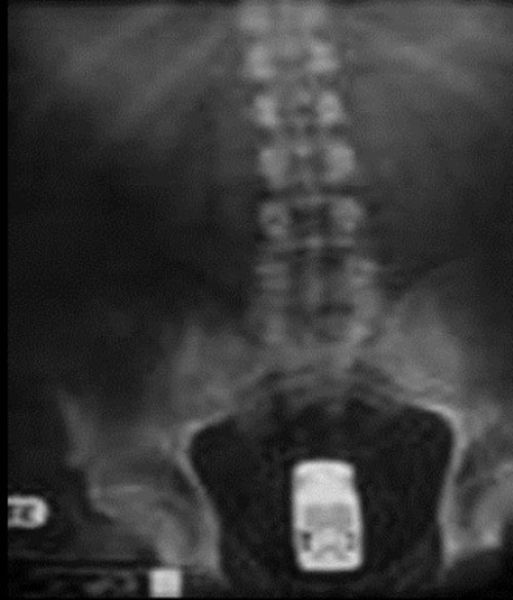 Real X-Rays That Will Shock and Astound You