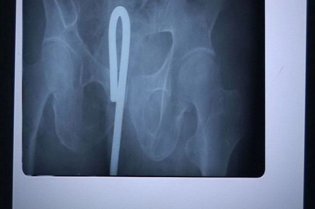 Real X-Rays That Will Shock and Astound You