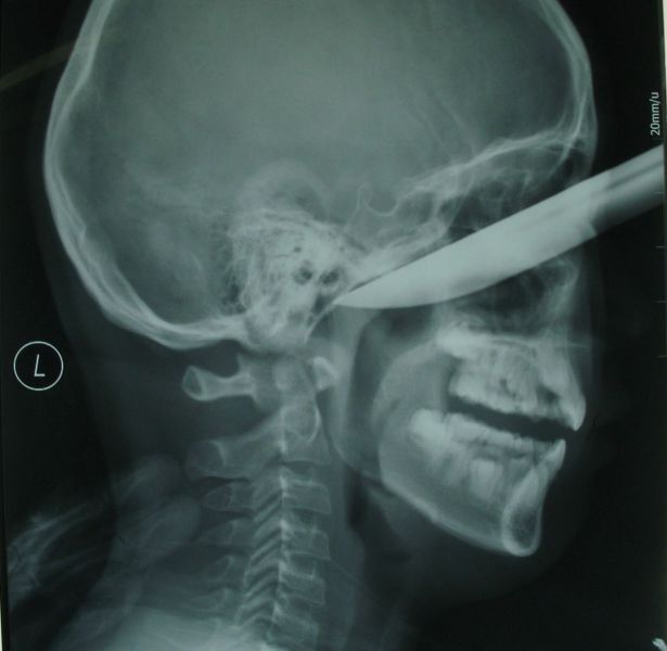 Real X-Rays That Will Shock and Astound You