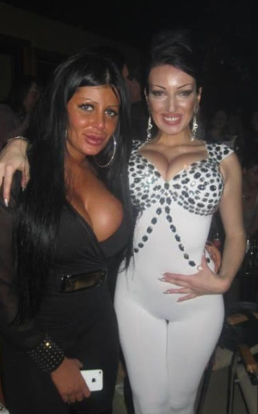 Queens of Disastrous Plastic Surgeries