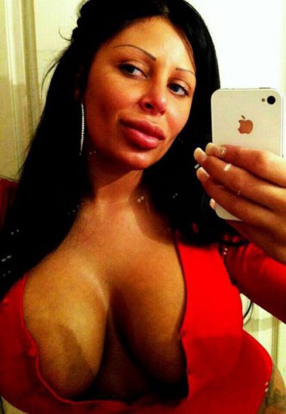 Queens of Disastrous Plastic Surgeries