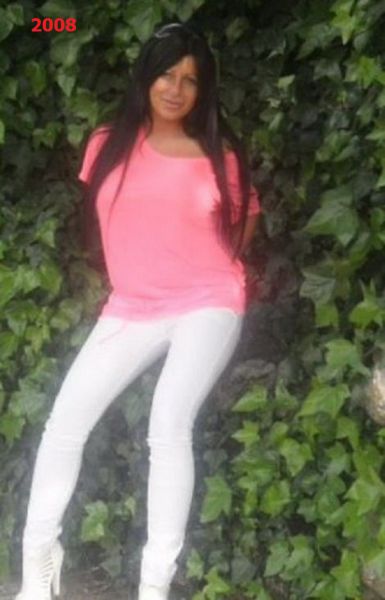 Queens of Disastrous Plastic Surgeries