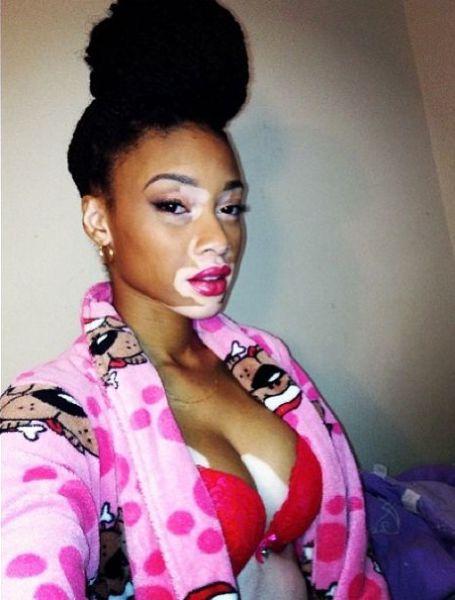 The Top Model without Stereotypical Good Looks