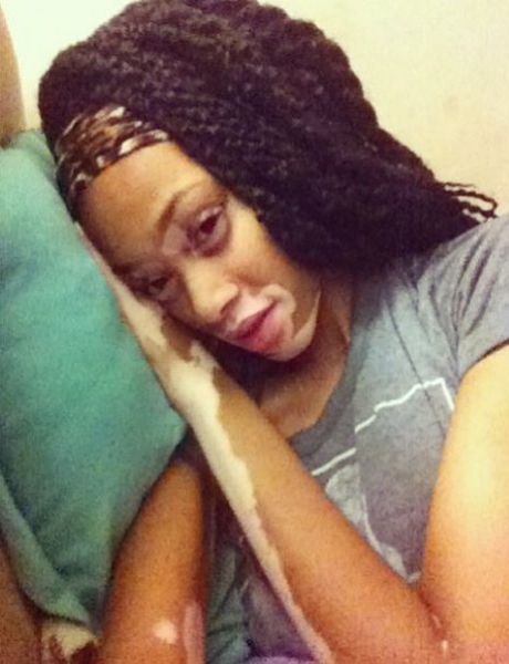 The Top Model without Stereotypical Good Looks