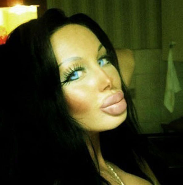Plastic Surgery Fails That Are Just Wrong