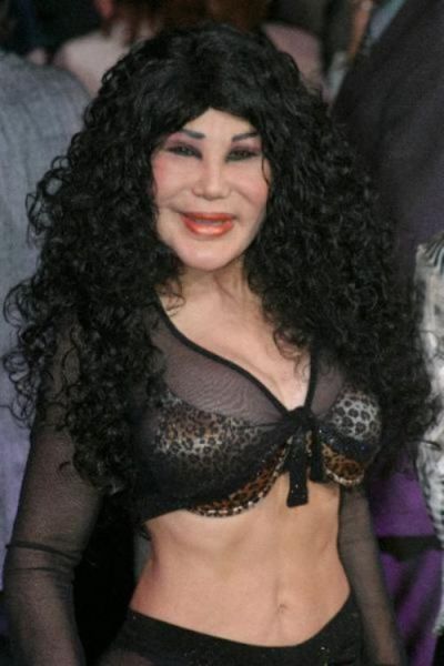 Plastic Surgery Fails That Are Just Wrong