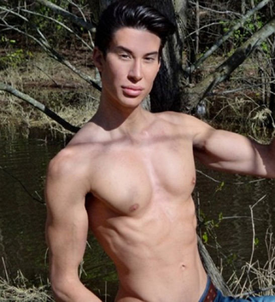 Plastic Surgery Fails That Are Just Wrong