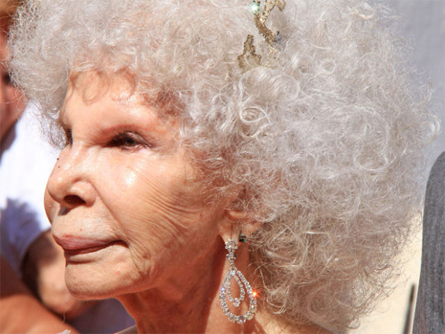 Plastic Surgery Fails That Are Just Wrong