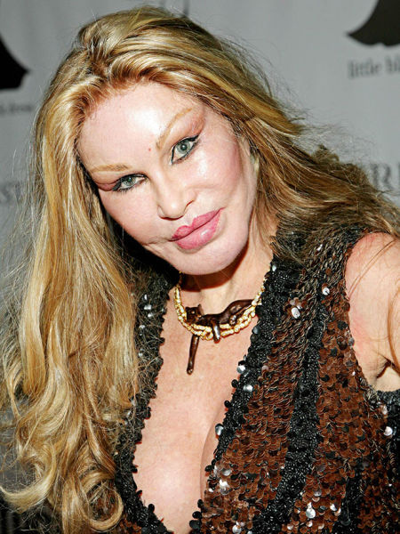 Plastic Surgery Fails That Are Just Wrong