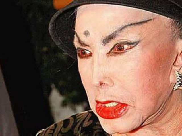 Plastic Surgery Fails That Are Just Wrong