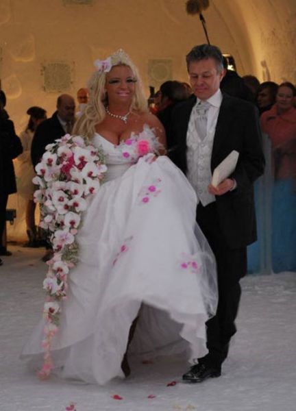 Plastic Surgery Fails That Are Just Wrong