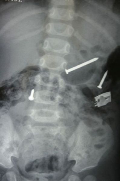 Real X-Rays That Are Will Shock You