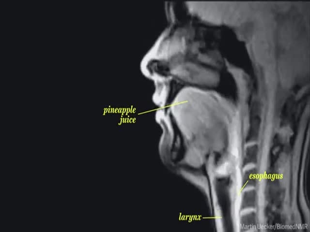 What Life Looks like Through an MRI Machine 