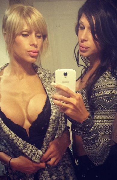 The Twins Who Have Had Identical Plastic Surgery