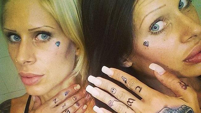 The Twins Who Have Had Identical Plastic Surgery