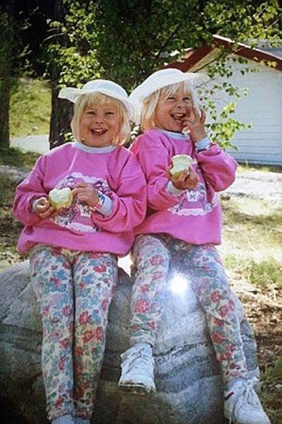 The Twins Who Have Had Identical Plastic Surgery