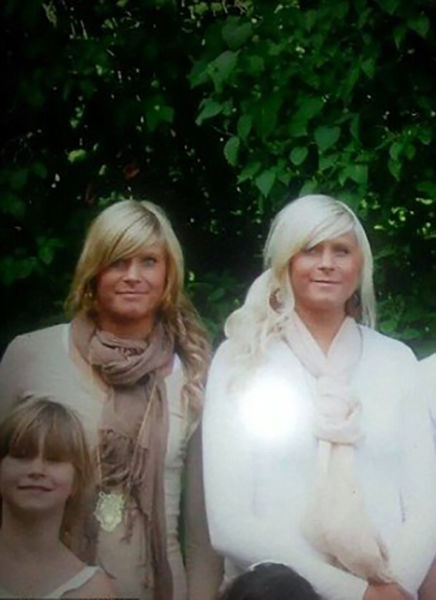 The Twins Who Have Had Identical Plastic Surgery