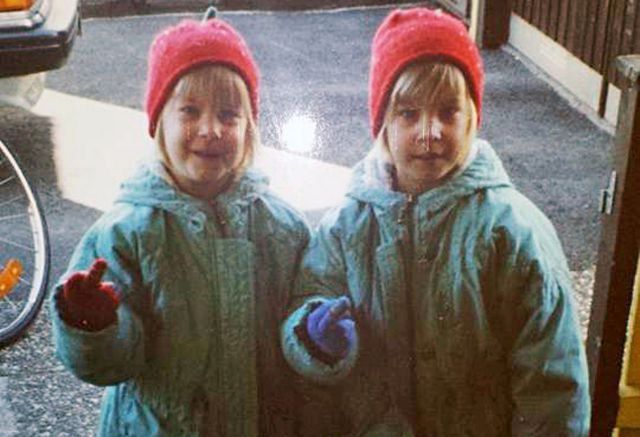 The Twins Who Have Had Identical Plastic Surgery