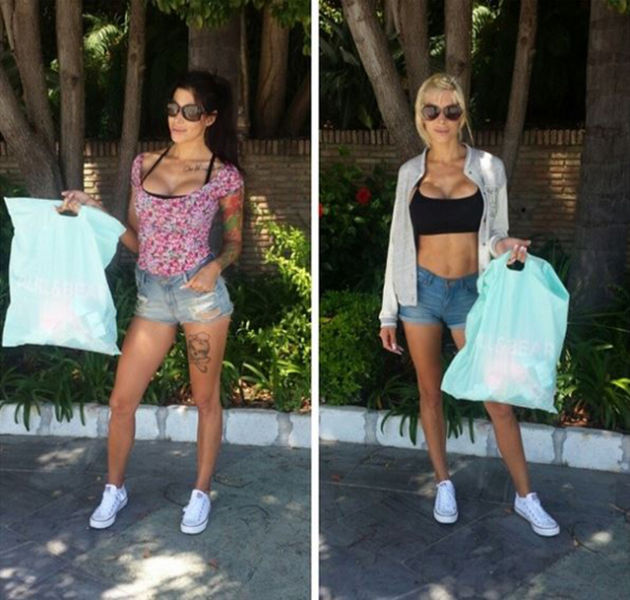 The Twins Who Have Had Identical Plastic Surgery