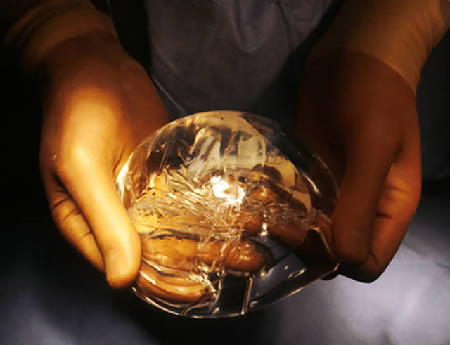 The Brutal Honest Truths about Boobs