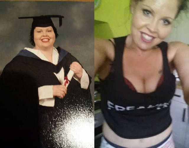 Skin Removal Operation Gives This Girl a New Body