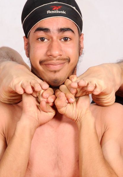 The Teenager Who Has Limbs Like Rubber