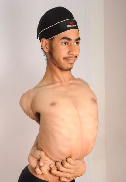 The Teenager Who Has Limbs Like Rubber