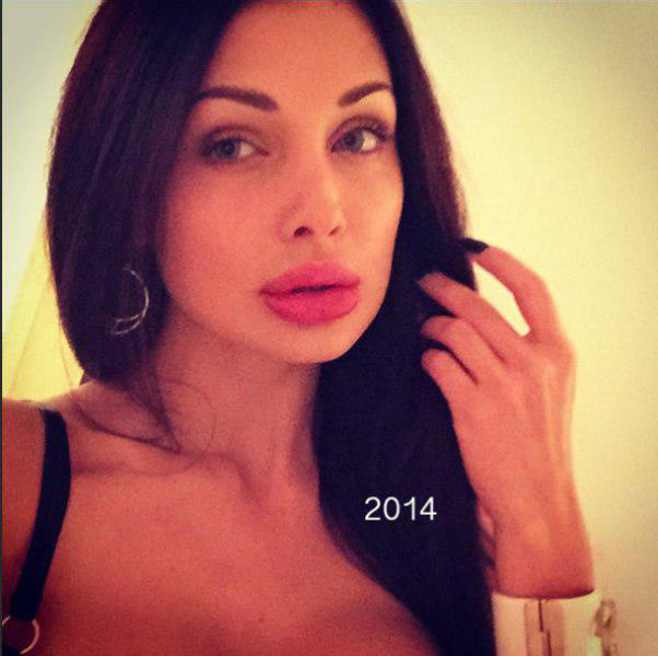 A Porn Star’s Dramatic Plastic Surgery Makeover