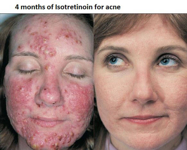 morning picdump 50 pics 3.html - 50 HD Photos | Premium Gallery 2015