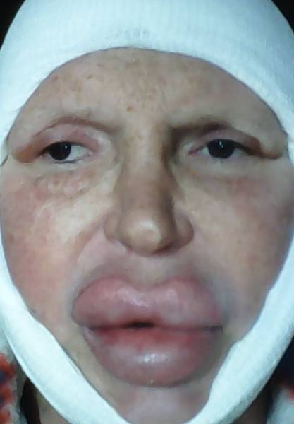 This Transgender Woman Has Taken Surgery Way Too Far