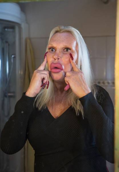 This Transgender Woman Has Taken Surgery Way Too Far