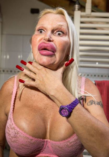 This Transgender Woman Has Taken Surgery Way Too Far