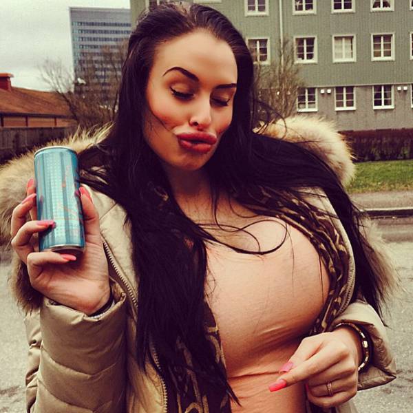 Victim Of The Silicone Injections