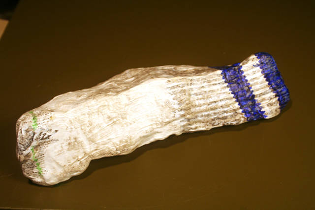 When Anal Sex Turns Into A Disaster